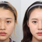 แพ็คเกจศัลยกรรมเกาหลี ดูแลครบจบในทริปเดียว