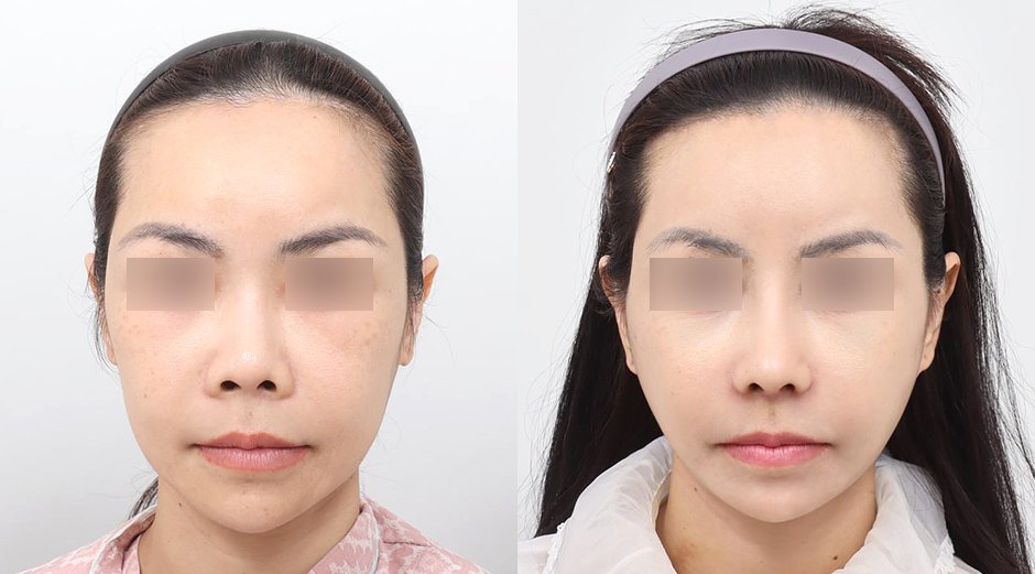 แพ็คเกจศัลยกรรมเกาหลี ดูแลครบจบในทริปเดียว