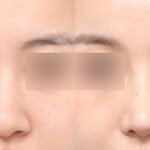 แพ็คเกจศัลยกรรมเกาหลี ดูแลครบจบในทริปเดียว