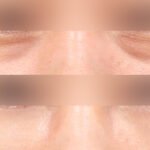 แพ็คเกจศัลยกรรมเกาหลี ดูแลครบจบในทริปเดียว