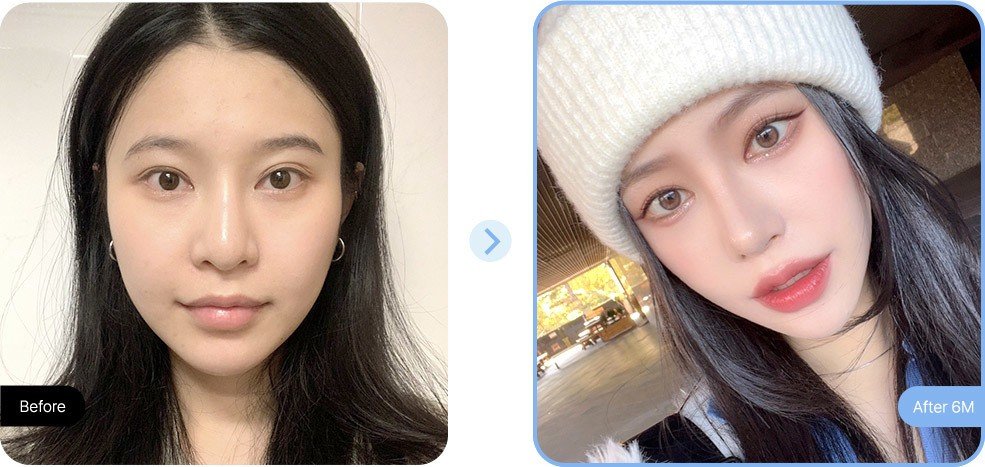 โรงพยาบาล