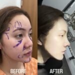 แพ็คเกจศัลยกรรมเกาหลี ดูแลครบจบในทริปเดียว